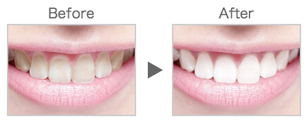 Before After